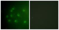 Rb (phospho Thr826) Polyclonal Antibody