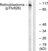 Rb (phospho Thr826) Polyclonal Antibody