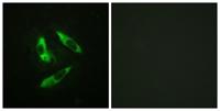 Rabphilin-3A (phospho Ser237) Polyclonal Antibody