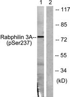 Rabphilin-3A (phospho Ser237) Polyclonal Antibody