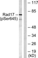 Rad17 (phospho Ser645) Polyclonal Antibody