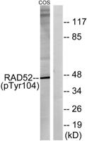 Rad52 (phospho Tyr104) Polyclonal Antibody