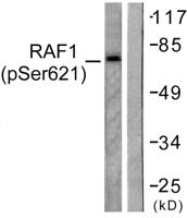 Raf-1 (phospho Ser621) Polyclonal Antibody