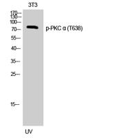 PKC α (phospho Thr638) Polyclonal Antibody