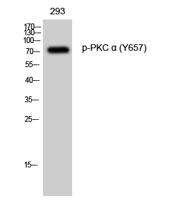 PKC α (phospho Tyr658) Polyclonal Antibody