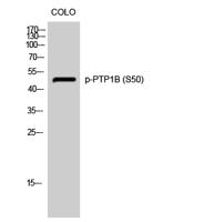 PTP1B (phospho Ser50) Polyclonal Antibody