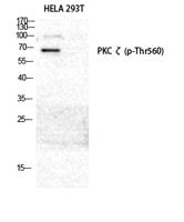 PKC ζ (phospho Thr560) Polyclonal Antibody