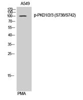 PKD1/2/3 (phospho Ser738/S742) Polyclonal Antibody