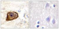PDGFR-β (phospho Tyr1021) Polyclonal Antibody