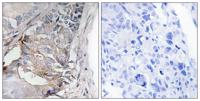 PDGFR-β (phospho Tyr740) Polyclonal Antibody