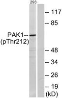 PAKα (phospho Thr212) Polyclonal Antibody