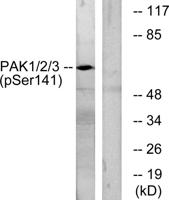 PAKα/β/γ (phospho Ser144/141/139) Polyclonal Antibody