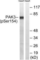 PAKβ (phospho Ser154) Polyclonal Antibody