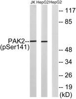 PAKγ (phospho Ser141) Polyclonal Antibody