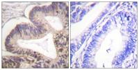 PAKγ (phospho Ser20) Polyclonal Antibody