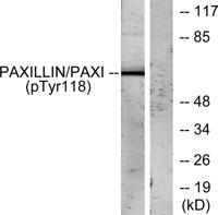 Paxillin (phospho Tyr118) Polyclonal Antibody