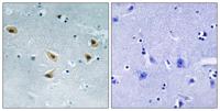 p53 (phospho Ser376) Polyclonal Antibody