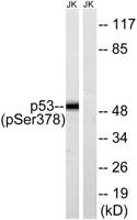 p53 (phospho Ser378) Polyclonal Antibody