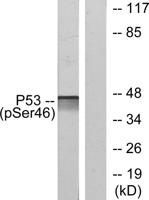 p53 (phospho Ser46) Polyclonal Antibody