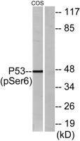 p53 (phospho Ser6) Polyclonal Antibody