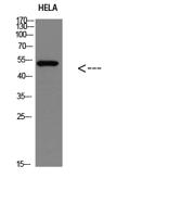 p53(Phospho Ser366) Polyclonal Antibody