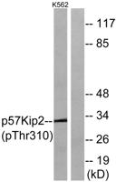 p57 (phospho Thr310) Polyclonal Antibody