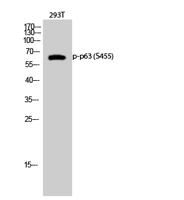 p63 (phospho Ser455) Polyclonal Antibody