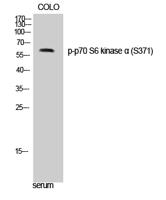 p70 S6 kinase α (phospho Ser371) Polyclonal Antibody