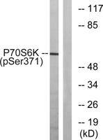 p70 S6 kinase α (phospho Ser371) Polyclonal Antibody