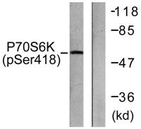 p70 S6 kinase α (phospho Ser418) Polyclonal Antibody