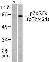 p70 S6 kinase α (phospho Thr444) Polyclonal Antibody