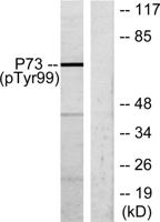 p73 (phospho Tyr99) Polyclonal Antibody