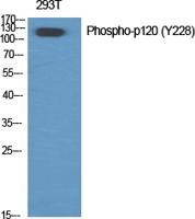 p120 (phospho Tyr228) Polyclonal Antibody