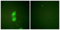 p120 (phospho Tyr228) Polyclonal Antibody