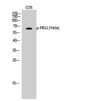 FRS2 (phospho Tyr436) Polyclonal Antibody