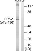 FRS2 (phospho Tyr436) Polyclonal Antibody