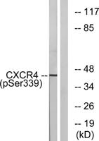 Fusin (phospho Ser339) Polyclonal Antibody