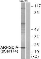 Rho GDIα (phospho Ser174) Polyclonal Antibody