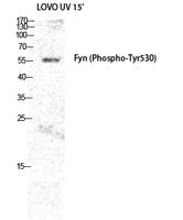 Fyn (phospho Tyr530) Polyclonal Antibody