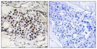 p16-INK4a (Phospho Ser152) rabbit pAb