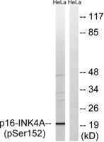 p16-INK4a (Phospho Ser152) rabbit pAb