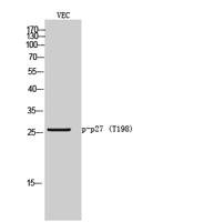 p27 (phospho Thr198) Polyclonal Antibody