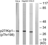 p27 (phospho Thr198) Polyclonal Antibody