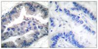 NBK (phospho Thr33) Polyclonal Antibody