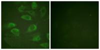 IL-2Rα (phospho Ser268) Polyclonal Antibody