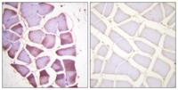 Ribosomal Protein S6 (phospho Ser240) Polyclonal Antibody