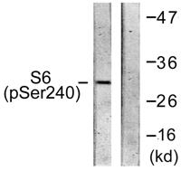 Ribosomal Protein S6 (phospho Ser240) Polyclonal Antibody