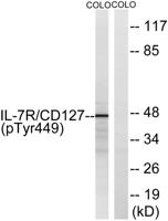 IL-7R (phospho Tyr449) Polyclonal Antibody