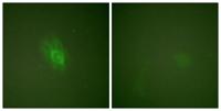 IκB-β (phospho Ser23) Polyclonal Antibody