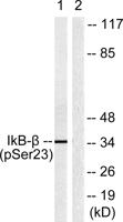 IκB-β (phospho Ser23) Polyclonal Antibody